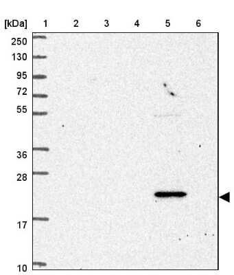 Western Blot: NBEAL1 Antibody [NBP2-33568] - Lane 1: Marker  [kDa] 250, 130, 95, 72, 55, 36, 28, 17, 10.  Lane 2: Human cell line RT-4.  Lane 3: Human cell line U-251MG sp.  Lane 4: Human plasma (IgG/HSA depleted).  Lane 5: Human liver tissue.  Lane 6: Human tonsil tissue