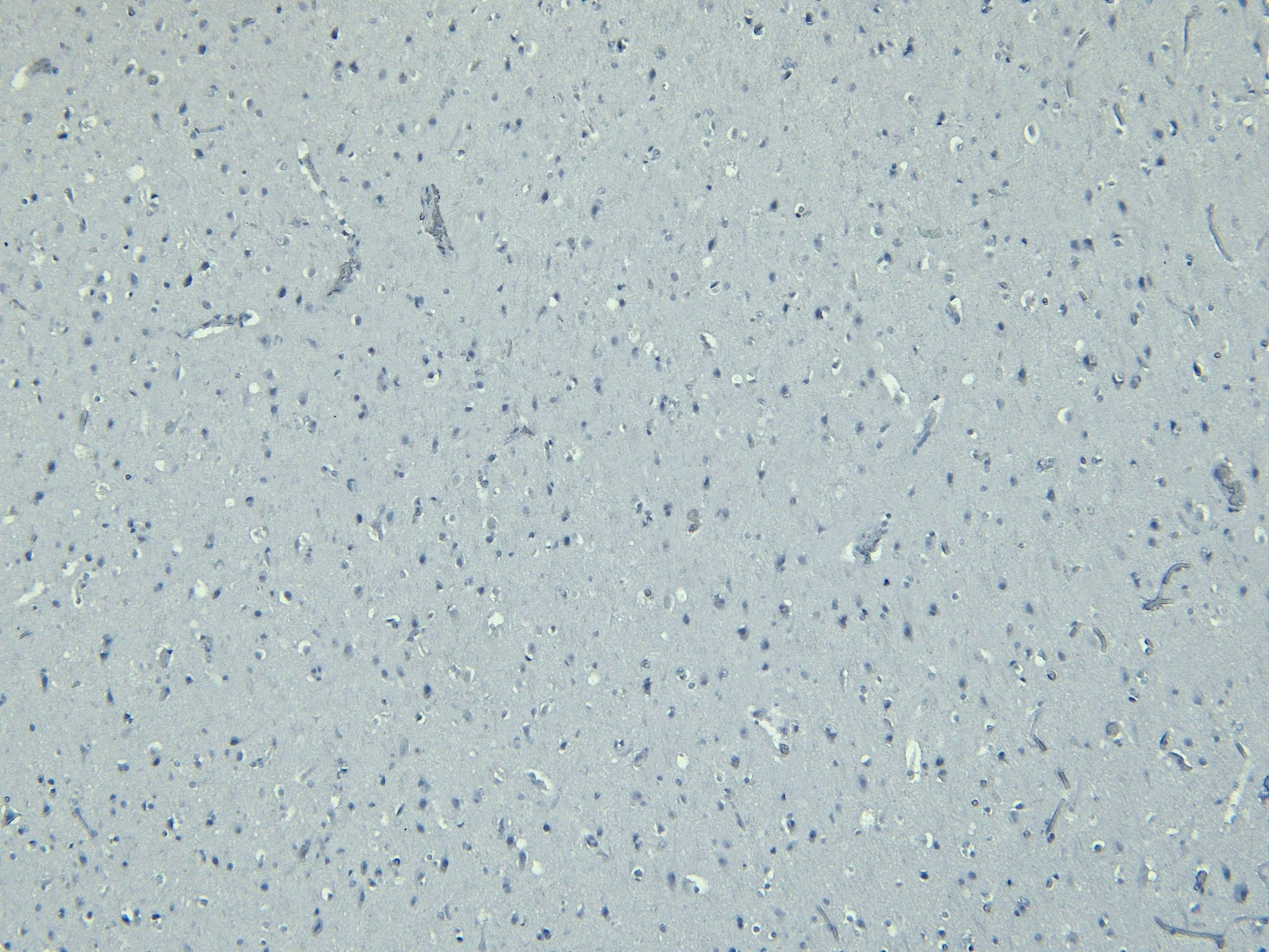 Immunohistochemistry-Paraffin: Doublecortin Antibody [NBP2-69992] - Negative Control showing staining of paraffin embedded Human Cortex, with no primary antibody.