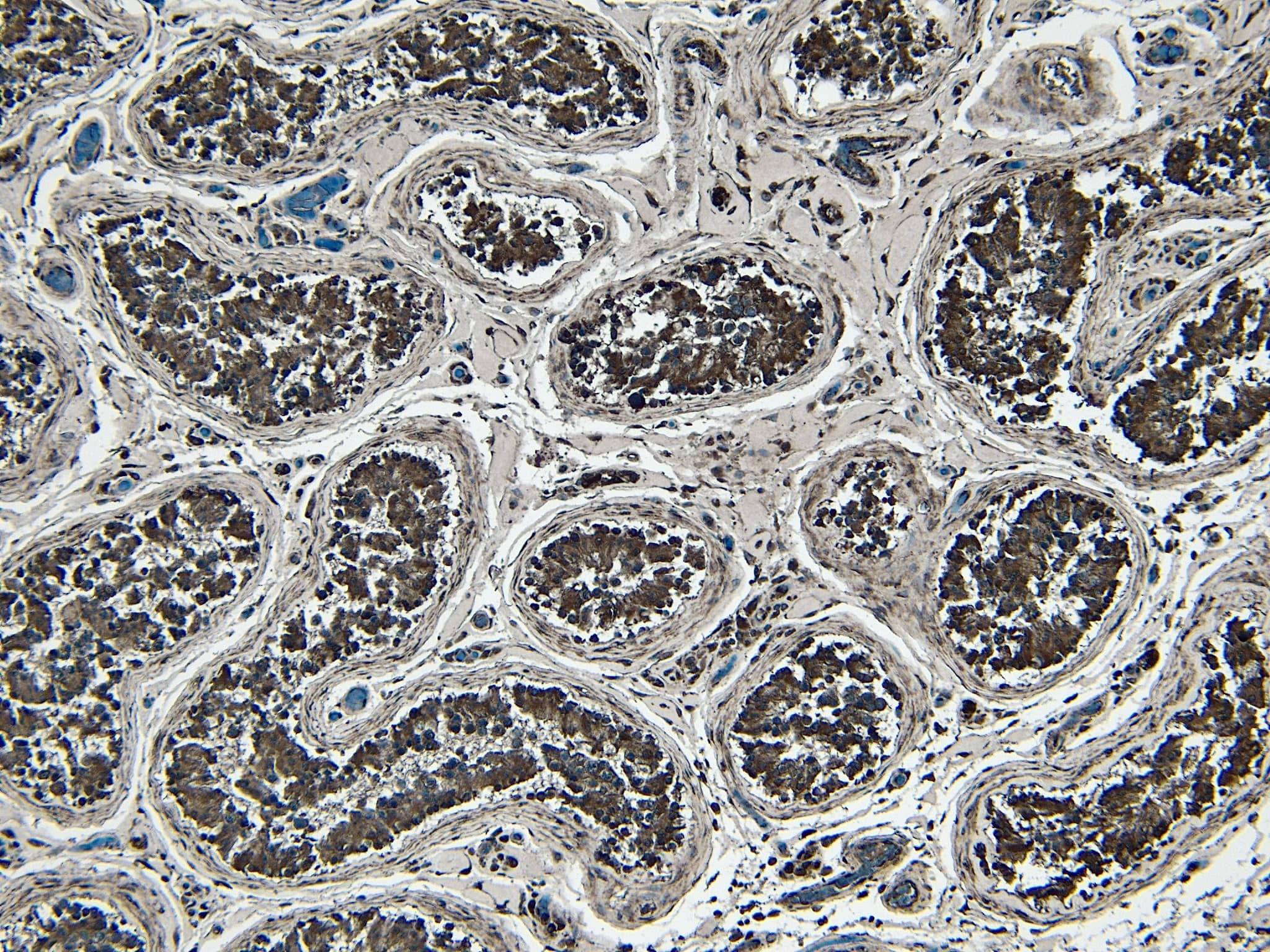 Immunohistochemistry-Paraffin: STAM-1 Antibody [NBP3-20227] - (6ug/ml) staining of paraffin embedded Human Testis. Heat induced antigen retrieval with citrate buffer pH 6, HRP-staining.