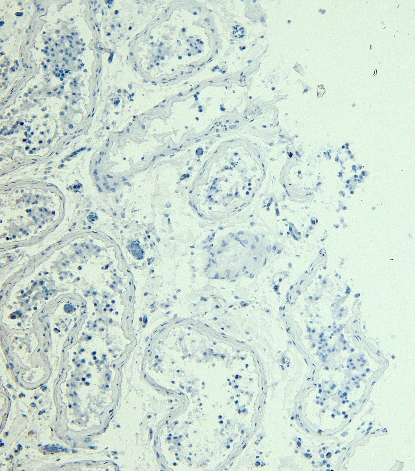 Immunohistochemistry-Paraffin: STAM-1 Antibody [NBP3-20227] - Negative Control showing staining of paraffin embedded Human Testis, with no primary antibody.