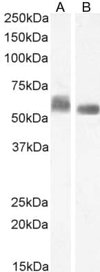 Western Blot: STAM-1 Antibody [NBP3-20227] - (1ug/ml) staining of K562 (A) and (0.5ug/ml) MCF7 (B) cell lysate (35ug protein in RIPA buffer). Detected by chemiluminescence.