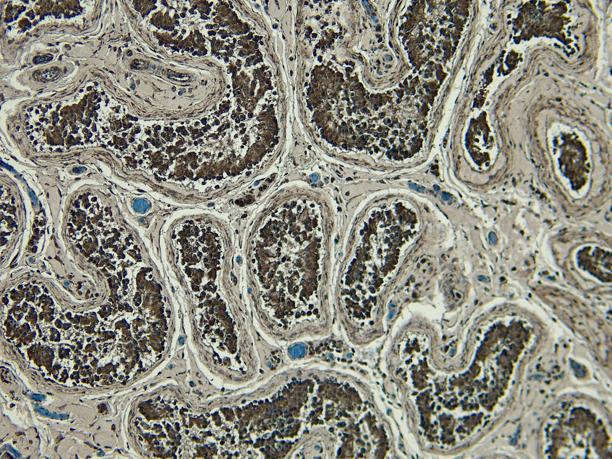 Immunohistochemistry-Paraffin: PLC-delta 3 Antibody [NBP3-20228] - (6ug/ml) staining of paraffin embedded Human Testis. Heat induced antigen retrieval with citrate buffer pH 6, HRP-staining.