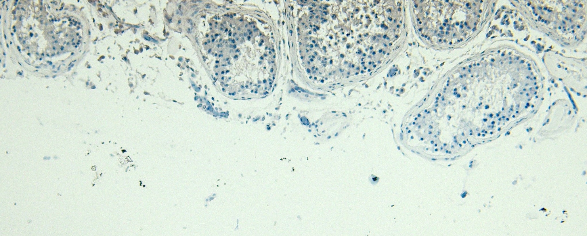 Immunohistochemistry-Paraffin: PLC-delta 3 Antibody [NBP3-20228] - Negative Control showing staining of paraffin embedded Human Testis, with no primary antibody.