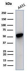 Western blot analysis of A431 cell lysate using Cytokeratin 14 antibody (KRT14/7054R).