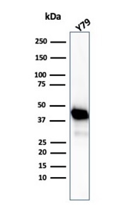 Western blot analysis of Y79 cell lysate using Creatine Kinase BB antibody (CKBB/6565).