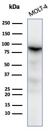 Western blot analysis of MOLT-4 cell lysates using Ku80/XRCC5 antibody (XRCC5/7316).