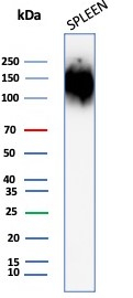 Western blot analysis of human spleen tissue lysate using CD45 antibody (rPTPRC/1147).