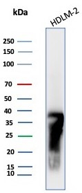 Western blot analysis of HDLM-2 cell lysate using HLA DRB1 antibody (HLA-DRB/7795R).