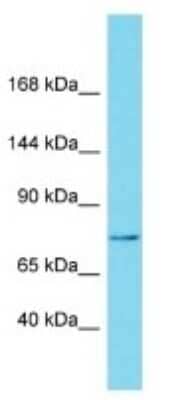 Western Blot: NBPF15 Antibody [NBP3-09717] - Western blot analysis of NBPF15 in Human Placenta. Antibody dilution at 1ug/ml