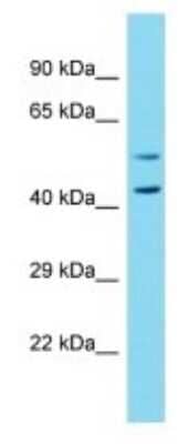 Western Blot: NBPF7 Antibody [NBP3-09752] - Western blot analysis of NBPF7 in Fetal Liver lysates. Antibody dilution at 1.0ug/ml