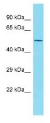 Western Blot: NBPF7 Antibody [NBP3-09753] - Western blot analysis of NBPF7 in Fetal Kidney lysates. Antibody dilution at 1.0ug/ml