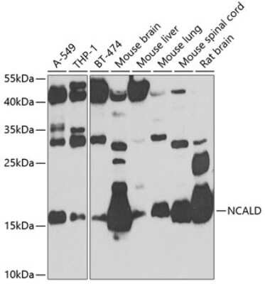 Western Blot: NCALD Antibody [NBP2-93693] - Analysis of extracts of various cell lines, using NCALD at 1:1000 dilution.Secondary antibody: HRP Goat Anti-Rabbit IgG (H+L) at 1:10000 dilution.Lysates/proteins: 25ug per lane.Blocking buffer: 3% nonfat dry milk in TBST.Detection: ECL Basic Kit .Exposure time: 90s.