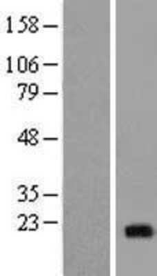 Western Blot: NCALD Overexpression Lysate (Adult Normal) [NBP2-09221] Left-Empty vector transfected control cell lysate (HEK293 cell lysate); Right -Over-expression Lysate for NCALD.