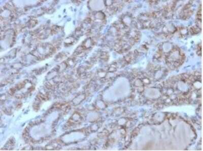 Immunohistochemistry-Paraffin: NCAM-1/CD56 Antibody (123A8 (same as 56C04)) - Azide and BSA Free [NBP2-34518] - Formalin-fixed, paraffin-embedded human thyroid stained with NCAM-1/CD56 Antibody (123A8 (same as 56C04)). HIER: Tris/EDTA, pH9.0, 45min. HRP-polymer, 30min. DAB, 5min.