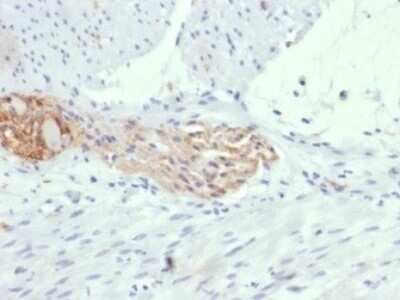 Immunohistochemistry-Paraffin: NCAM-1/CD56 Antibody (123A8 (same as 56C04)) - Azide and BSA Free [NBP2-34518] - Formalin-fixed, paraffin-embedded human colon stained with NCAM-1/CD56 Antibody (123A8 (same as 56C04)).