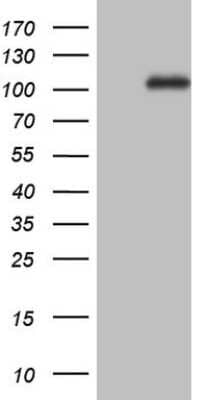 Western Blot: NCAM-1/CD56 Antibody (1B9) [NBP2-46107] - Analysis of HEK293T cells were transfected with the pCMV6-ENTRY control (Left lane) or pCMV6-ENTRY NCAM1.