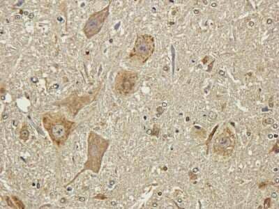 Immunohistochemistry: NCAM-1/CD56 Antibody (735) - Chimeric [NBP2-52669] - Formalin fixed rat spinal chord slices were were stained with a NBP2-52669 at 3 ug/ml.