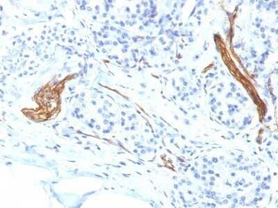 Immunohistochemistry-Paraffin: NCAM-1/CD56 Antibody (NCAM1/1496) [NBP2-53391] - Formalin-fixed, paraffin-embedded human Pancreas stained with CD56 Monoclonal Antibody (NCAM1/1496)