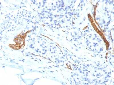 Immunohistochemistry-Paraffin: NCAM-1/CD56 Antibody (NCAM1/1496) [NBP2-54482] - Formalin-fixed, paraffin-embedded human Pancreas stained with CD56 Monoclonal Antibody (NCAM1/1496)