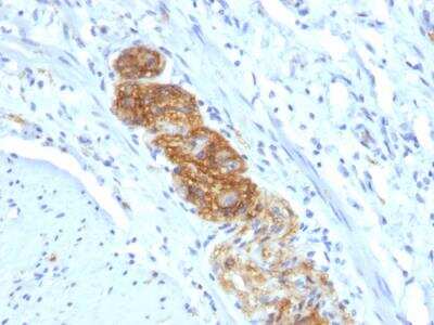 Immunohistochemistry-Paraffin: NCAM-1/CD56 Antibody (NCAM1/784) - IHC-Prediluted [NBP2-48192] - Formalin-fixed, paraffin-embedded human Colon stained with CD56 Monoclonal Antibody (NCAM1/784)