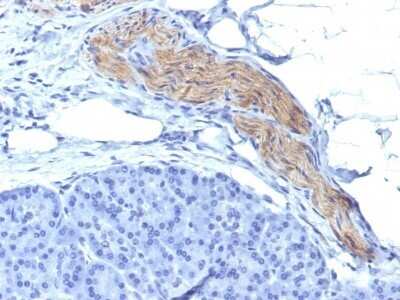 Immunohistochemistry-Paraffin: NCAM-1/CD56 Antibody (NCAM1/795) - Azide and BSA Free [NBP2-47826] - Formalin-fixed, paraffin-embedded human Pancreas stained with NCAM-1/CD56 Antibody (NCAM1/795).