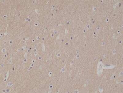 Immunohistochemistry-Paraffin: NCAM-1/CD56 Antibody (RM315) [NBP2-61567] - Staining of formalin fixed and paraffin embedded human brain tissue section using anti-CD56 rabbit monoclonal antibody at a 1:1000 dilution.