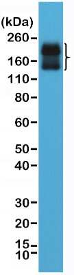 Western Blot: NCAM-1/CD56 Antibody (RM315) [NBP2-61567] - Western Blot of human brain tissue lysate using NBP2-61567.