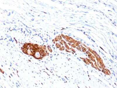 Immunohistochemistry-Paraffin: NCAM-1/CD56 Antibody (SPM128) - Azide and BSA Free [NBP2-34397] - Formalin-paraffin human colon ganglion stained with CD56 MAb (SPM128)