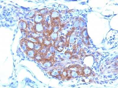 Immunohistochemistry-Paraffin: NCAM-1/CD56 Antibody (SPM128) - Azide and BSA Free [NBP2-34397] - Formalin-fixed, paraffin-embedded human Pancreas stained with NCAM-1/CD56 Antibody (SPM128)