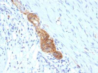 Immunohistochemistry-Paraffin: NCAM-1/CD56 Antibody (SPM489) - Azide and BSA Free [NBP2-34412] - Formalin-fixed, paraffin-embedded human colon stained with CD56 Monoclonal Antibody (SPM489)