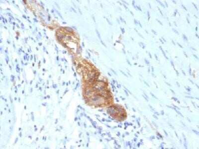 Immunohistochemistry-Paraffin: NCAM-1/CD56 Antibody (SPM489) - IHC-Prediluted [NBP2-44714] - Formalin-fixed, paraffin-embedded human colon stained with CD56 Monoclonal Antibody (SPM489)