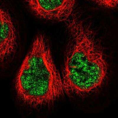 Immunocytochemistry/Immunofluorescence: NCAPG2 Antibody [NBP1-86633] - Staining of human cell line A-431 shows localization to nuclear speckles. Antibody staining is shown in green.