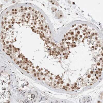 Immunohistochemistry-Paraffin: NCAPG2 Antibody [NBP1-86633] - Staining of human testis shows moderate to strong nuclear positivity in cells in seminiferous ducts and Leydig cells.