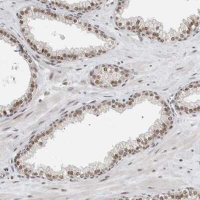 Immunohistochemistry-Paraffin: NCAPG2 Antibody [NBP1-86633] - Staining of human prostate shows moderate nuclear positivity in glandular cells.