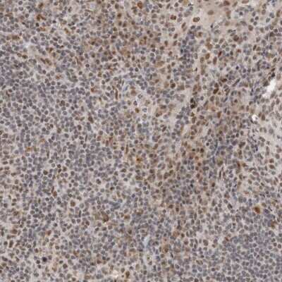 Immunohistochemistry-Paraffin: NCAPG2 Antibody [NBP1-86633] - Staining of human tonsil shows moderate nuclear positivity in germinal center and non-germinal center cells.