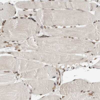 Immunohistochemistry-Paraffin: NCAPG2 Antibody [NBP1-86633] - Staining of human skeletal muscle shows weak to moderate nuclear positivity in myocytes.