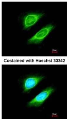 Immunocytochemistry/Immunofluorescence: NCAPH Antibody [NBP1-32573] - Analysis of methanol-fixed HeLa, using antibody at 1:200 dilution.