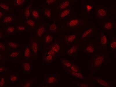 Immunocytochemistry/Immunofluorescence: NCAPH Antibody [NBP2-97603] - Immunofluorescence staining of NCAPH in U2OS cells. Cells were fixed with 4% PFA, permeabilzed with 0.1% Triton X-100 in PBS, blocked with 10% serum, and incubated with rabbit anti-Human NCAPH polyclonal antibody (dilution ratio 1:500) at 4C overnight. Then cells were stained with the Alexa Fluor(R)594-conjugated Goat Anti-rabbit IgG secondary antibody (red). Positive staining was localized to Nucleus.