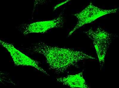 Immunocytochemistry/Immunofluorescence: NCAPH Antibody [NBP2-98781] - Staining of NCAPH in HeLa cells. Cells were fixed with 4% PFA, permeabilzed with 0.3% Triton X-100 in PBS,blocked with 10% serum, and incubated with rabbit anti-human NCAPH polyclonal antibody (1:1000) at 4? overnight. Then cells were stained with the Alexa Fluor®488-conjugated Goat Anti-rabbit IgG secondary antibody (green).Positive staining was localized to cytoplasm and nucleus.