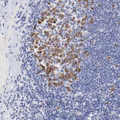 Immunohistochemistry-Paraffin: NCAPH Antibody [NBP1-88345] - Staining of human tonsil shows nuclear positivity in germinal center cells.