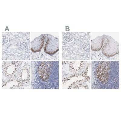 Immunohistochemistry-Paraffin: NCAPH Antibody [NBP1-88345] - Staining of human kidney, skin, testis and tonsil using Anti-NCAPH antibody NBP1-88345 (A) shows similar protein distribution across tissues to independent antibody NBP1-88346 (B).