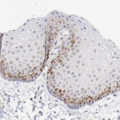 Immunohistochemistry-Paraffin: NCAPH Antibody [NBP1-88346] - Staining of human skin shows nuclear positivity in epidermal cells.