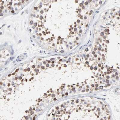 Immunohistochemistry-Paraffin: NCAPH Antibody [NBP1-88346] - Staining of human testis shows nuclear positivity in cells in seminiferous ducts.