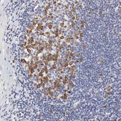 Immunohistochemistry-Paraffin: NCAPH Antibody [NBP1-88346] - Staining of human tonsil shows nuclear positivity in germinal center cells.