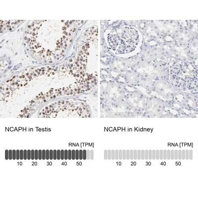 <b>Orthogonal Strategies Validation. </b>Immunohistochemistry-Paraffin: NCAPH Antibody [NBP1-88346] - Staining in human testis and kidney tissues . Corresponding NCAPH RNA-seq data are presented for the same tissues.