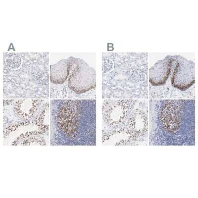 <b>Independent Antibodies Validation and Orthogonal Strategies Validation.</b>Immunohistochemistry-Paraffin: NCAPH Antibody [NBP1-88346] - Staining of human kidney, skin, testis and tonsil using Anti-NCAPH antibody NBP1-88346 (A) shows similar protein distribution across tissues to independent antibody NBP1-88345 (B).