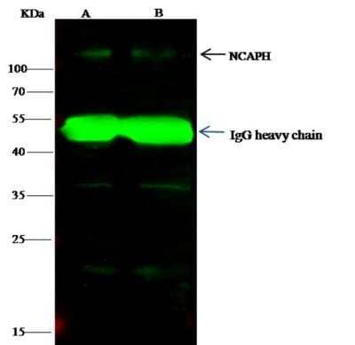 Immunoprecipitation: NCAPH Antibody [NBP2-98781] - Lane A:0.5 mg K562 Whole Cell LysateLane B:0.5 mg HepG2 Whole Cell Lysate4 uL anti-NCAPH rabbit polyclonal antibody and 15 ul of 50 % Protein G agarose.Primary antibody:Anti-NCAPH rabbit polyclonal antibody,at 1:100 dilution Secondary antibody:Dylight 800-labeled antibody to rabbit IgG (H+L), at 1:5000 dilution Developed using the odssey technique.Performed under reducing conditions.Predicted band size: 83 kDaObserved band size: 110 kDa