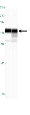 Simple Western: NCAPH Antibody [NBP1-88345] - Simple Western lane view shows a specific band for NCAPH in 0.2 mg/ml of RT-4 (Left) and U-251MG (Right) lysate. This experiment was performed under reducing conditions using the 12-230 kDa separation system.