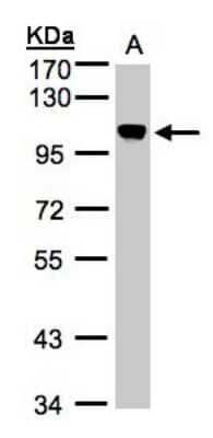 Western Blot: NCAPH Antibody [NBP1-32573] - Sample(30 ug whole cell lysate)A:Hep G2  7. 5% SDS PAGE, antibody diluted at 1:1000.