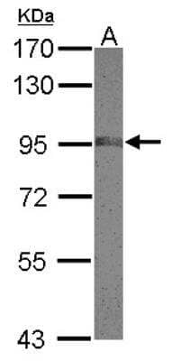 Western Blot: NCAPH Antibody [NBP2-19483] - Sample (30 ug of whole cell lysate) A: HeLa 7. 5% SDS PAGE gel, diluted at 1:500.